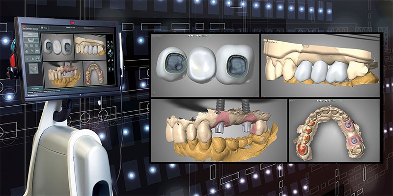 Digital implant dentistry 